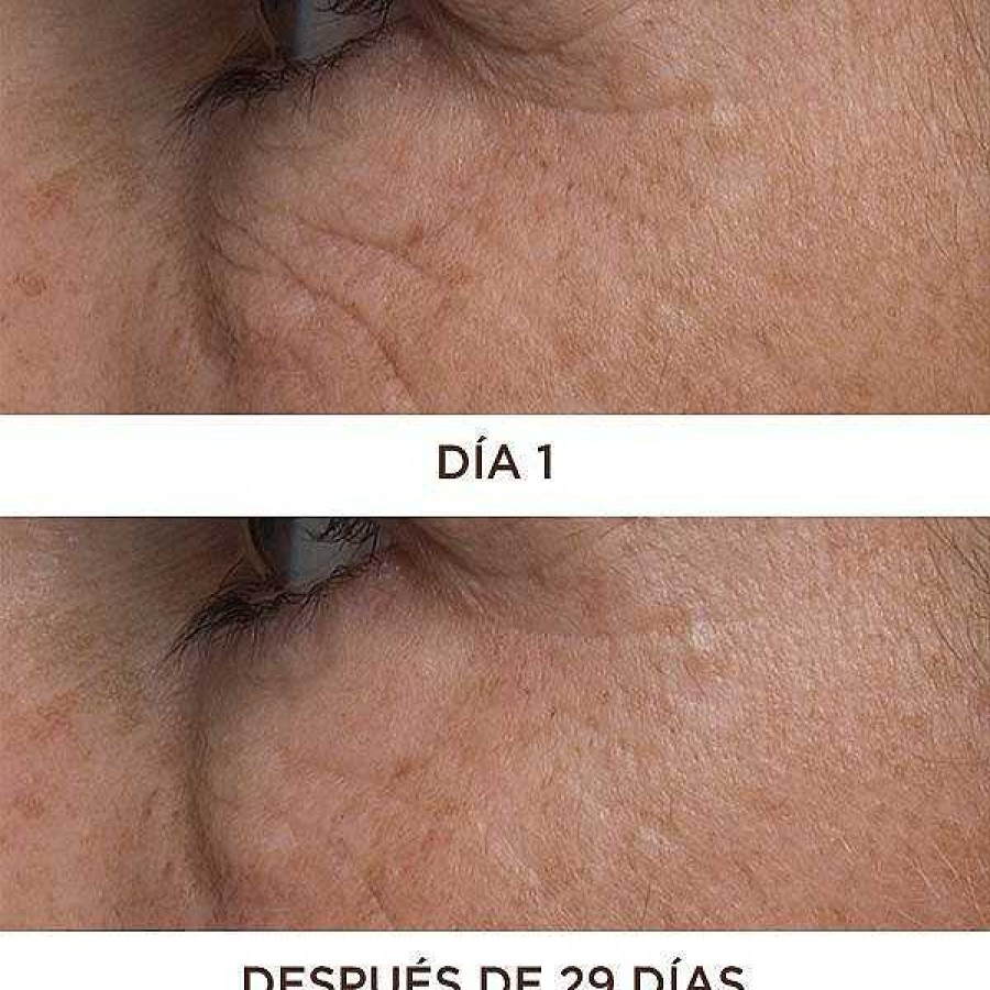 Contorno De Ojos | PERRICONE MD Cold Plasma Plus + Eye